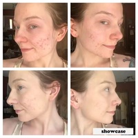 Tigre Herbe Couleur Correcteur Traitement Crème Spf 30 Apaise Le Look De Rouge Blanchissant Protection Solaire Dissimuler Les Boutons Crème Pour Le Visage