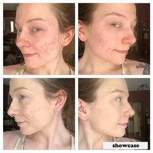 Tiger Grass Crema de tratamiento corrector de color Spf 30 calma el aspecto de blanqueamiento rojo Protección solar Ocultar espinillas Crema facial - Product Image 4