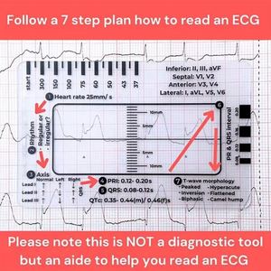 Règle de mesure ECG à 7 étapes pour l'interprétation, outil de mesure en plastique transparent, rapporteur EKG, référence pour les infirmières - Product Image 2