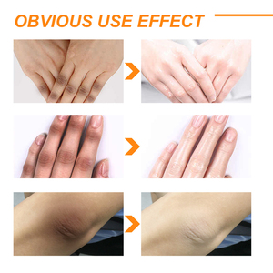 Private label cura della pelle bellezza forte <span class=keywords><strong>esfoliante</strong></span> arancia vitamina C <span class=keywords><strong>peeling</strong></span> schiarente sbiancante idratante lozione <span class=keywords><strong>peeling</strong></span> <span class=keywords><strong>corpo</strong></span> - Product Image 6