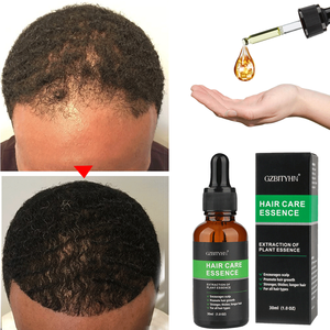 Private Label Ginger Natural Organic Hyaluronic Acid Nourishing Fluffy Anti Loss Regrowth Biotin Fast Hair Growth Oil Serum - Product Image 6