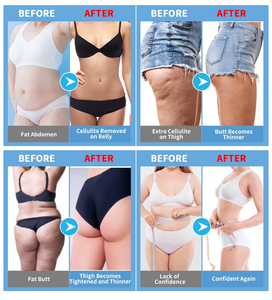 <span class=keywords><strong>2026</strong></span> Bestseller 3-in-1 Elektrisches Körperformungs-Massagegerät Fettverbrenner Po-Lifting Körperformung Cellulite-Massagegerät - Product Image 6