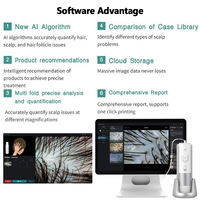 Analyseur intelligent de cheveux et de cuir chevelu Ai avec caméra HD 16Mp et zoom 10X-200X pour un diagnostic précis du follicule pileux et de la sensibilité du cuir chevelu