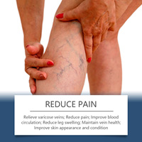 OEM Spray de soin des varices avec extraits de plantes pour apaiser les jambes et améliorer la circulation sanguine pour un soin général du corps