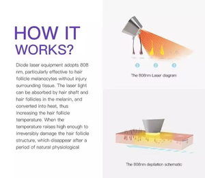 Máquina Profesional de Depilación Láser OPT SHR IPL, Rejuvenecimiento Cutáneo No Invasivo, Equipo Estético - Product Image 5