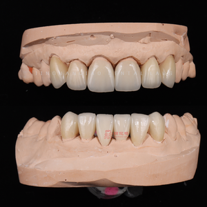 Carilla de cerámica de porcelana para dentaduras postizas de alta calidad, personalización privada para el cuidado <span class=keywords><strong>dental</strong></span>, recuperación oral - Product Image 6