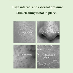 Nhà Máy Giá OEM bong bóng sâu mặt nạ sửa chữa Làm sạch sâu Mặt nạ chăm sóc da sáng màu xanh lá cây trà mặt bùn Mặt nạ đất sét - Product Image 6