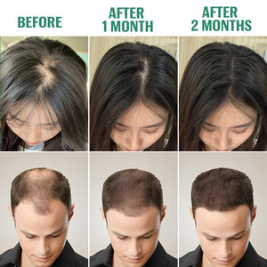 Soin Capillaire Traitant au Biotine et Caféine Naturels pour Cuir Chevelu, Sérum Croissance Capillaire Batana et Romarin, Huile en <span class=keywords><strong>Spray</strong></span> pour <span class=keywords><strong>Cheveux</strong></span> Clairsemés et <span class=keywords><strong>Repousse</strong></span> - Product Image 6