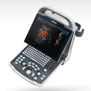 Sistema <span class=keywords><strong>de</strong></span> Diagnóstico por <span class=keywords><strong>Ultrasonido</strong></span> Doppler Color Digital Portátil Mindray DP-30 con Imágenes <span class=keywords><strong>de</strong></span> Alta Resolución para Uso Clínico - Product Image 5