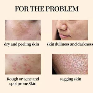 Crema Reparadora de Caracol al por Mayor de 50 ml para el Cuidado Facial, Aumenta la Elasticidad de la Piel, Mejora la Opacidad - Product Image 3