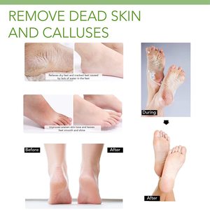 Bán Hot mềm chân Peel booties cho Callus da chết, có được cảm ứng mềm mại mịn chân trong 1 tuần tẩy tế bào chết chân lột mặt nạ - Product Image 6