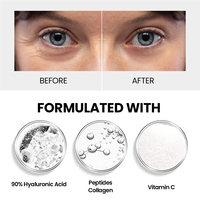 Masque pour les yeux à micro-aiguilles au collagène, marque privée OEM, patchs pour les yeux anti-rides, acide hyaluronique, patch pour les yeux à micro-aiguilles