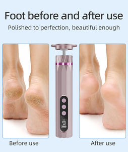 Appareil électrique portable pour le soin des pieds, éliminateur de callosités, machine de pédicure pour la maison et les voyages - Product Image 5