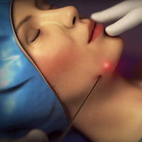 Corps professionnel d'équipement de lipolyse de laser de Lipo formant le dispositif laser avec le levage Endo de laser de diode de Triangel 980nm de la CE