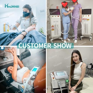 הזדמנויות עסקיות מפיץ המחיר הטוב ביותר הסיטונאי q החליף לייזר הסרת קעקוע - Product Image 6