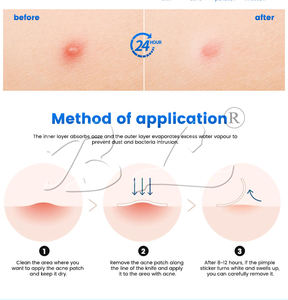 Nuevo tipo de vendaje hidrocoloide y película de absorción líquida Pu, vendajes adhesivos para dedos, dedos de los pies - Product Image 2