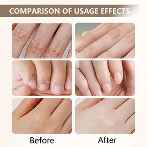 Crema de Manos Humectante e Iluminadora con Niacinamida Personalizada de Fábrica para Reparar las Manos y Prevenir la Sequedad y las Grietas - Product Image 5