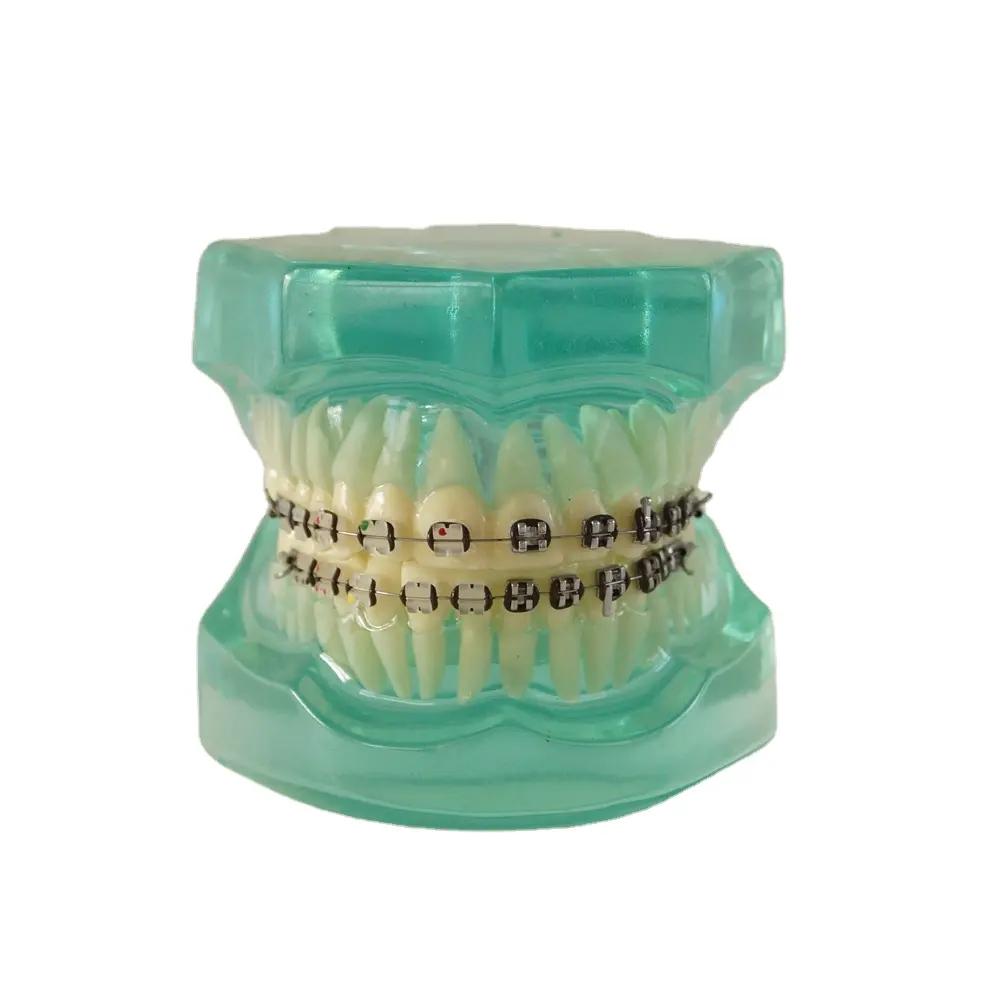 Dentaria ortodontica modello denti con supporto in metallo e ceramica