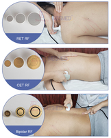 Appareil de physiothérapie portable CET RET à diathermie 448 kHz Tecar, en promotion aux États-Unis, pour la rééducation et le soulagement de la douleur sciatique