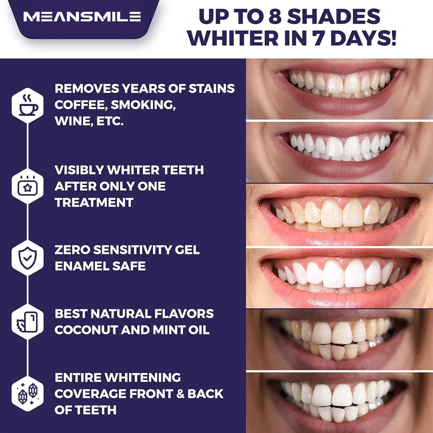 MEANSMILE 20 tedavi diş beyazlatma şeritleri özel etiket damla nakliye