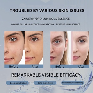 Rodillo Dermico Derivado de Vitamina C Suero de <span class=keywords><strong>Ácido</strong></span> Hialurónico 5ml Grado Médico OEM para Iluminar La Cara Antioxidante Antienvejecimiento - Product Image 4