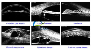 Mikroskop Bio <span class=keywords><strong>Ultrasound</strong></span> optikal mata Lab klinik rumah sakit medis mikroskop UTM UBM3200S skala penuh portabel - Product Image 6