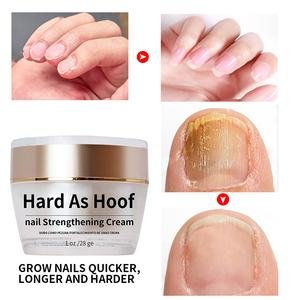 <span class=keywords><strong>Crema</strong></span> per la crescita delle <span class=keywords><strong>unghie</strong></span> naturale <span class=keywords><strong>crema</strong></span> per cuticole <span class=keywords><strong>crema</strong></span> per il rafforzamento delle <span class=keywords><strong>unghie</strong></span> per la cura delle <span class=keywords><strong>unghie</strong></span> dei piedi delle <span class=keywords><strong>mani</strong></span> - Product Image 2