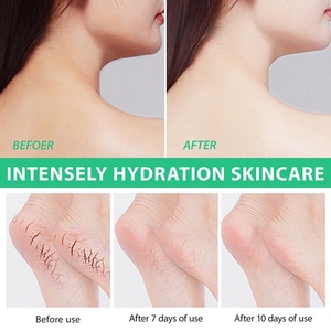 Crema para el Cuidado de los Pies en Oferta, 42% Urea, Exfolia Suavemente la Piel Muerta, Repara la Piel Agrietada, Árbol de Té, Aloe Vera, Ácido Hialurónico - Product Image 5