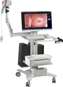 女性用ミニデジタルカメラビデオコルポスコープ - Product Image 5