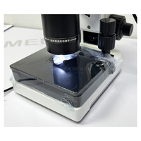 Microscope capillaire pour ongles SY-B198 avec écran 9 pouces, dispositif d'observation de la microcirculation DC12V
