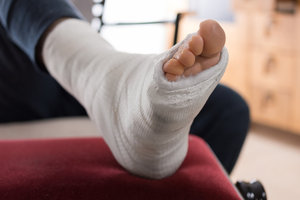 医療用Orthoグラスファイバーキャストカラーは整形外科用キャスティングテープメーカーKANGDAを供給しています