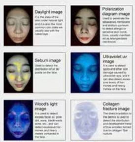 Advanced Skin Analyzer for Professional Skin Care Solutions for Deep Skin Analysis and Treatment with 3D Skin Imaging Technology - Product Image 4