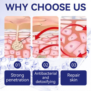 Оптовая продажа травяного крема от лишая, экземы, зуда, акне, грибковых инфекций, антибактериальная мазь - Product Image 4