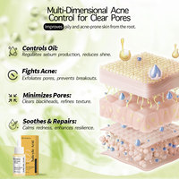 Sérum Anti-Acné à l'Acide Salicylique et au Niacinamide Marque Blanche Usine – Sérum Visage Purifiant et Séborégulateur pour Réduire les Points Noirs – Soin de la Peau