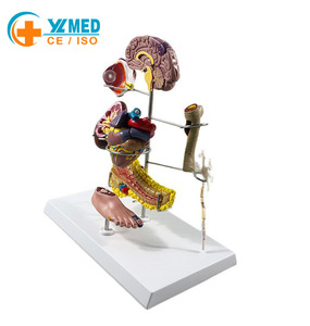 Modelo de Enseñanza de Anatomía Humana para Ciencias Médicas: Pie Diabético para Educación en Endocrinología y Patofisiología, Escuela de Medicina - Product Image 1