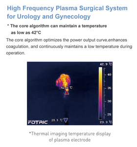 Sistema Quirúrgico de Plasma para <span class=keywords><strong>Urología</strong></span> y Ginecología HF-800CIII de 380/150W, Unidad Electroquirúrgica de Alta Frecuencia - Product Image 5
