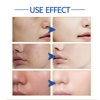 Sérum Herbicos pour le soin de la peau du corps, élimination des taches brunes, des cernes, des ridules, correction des cicatrices d'acné, effet liftant pour le visage, essence illuminatrice