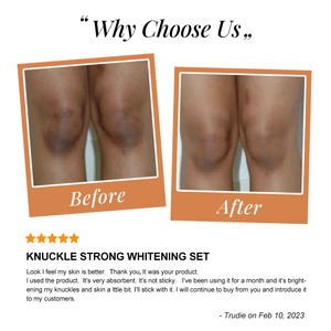 Özel etiket cilt bakımı aydınlatıcı koyu Knuckle dizler beyazlatma siyah cilt beyazlatma kremi tam Set siyah kadınlar için koyu cilt - Product Image 3
