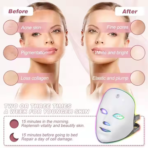 Mascarilla Facial Profesional de Belleza con Luz, Estilo 2025, Alta Calidad, Siete Colores - Product Image 6