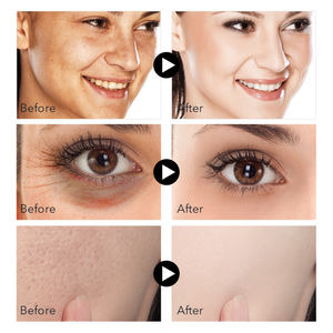 Juego de esencia Facial para el cuidado de la piel, oro de 24 quilates, blanqueamiento hidratante, suero reparador antienvejecimiento, juegos dorados - Product Image 5