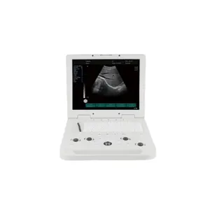 Strumenti medici ad ultrasuoni in bianco e nero Scanner ad ultrasuoni portatile completamente digitale B/n macchina ad ultrasuoni