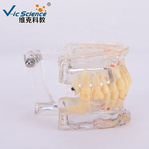 Modèle <span class=keywords><strong>dentaire</strong></span> scientifique médical avec dent manquante pour la formation dans les écoles et les hôpitaux - Vic Science - Product Image 2