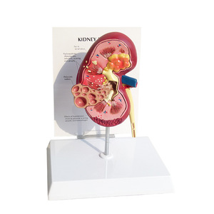 Modèle de pathologie rénale humaine pour les sciences médicales, modèle de maladie organique, modèle anti-médicament - Product Image 2