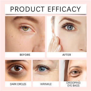 Crème anti-cernes OEM 10g, fini léger et lisse, illuminateur éclaircissant pour le contour des yeux, usage quotidien - Product Image 5