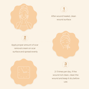 Crème anti-vergetures avancée <span class=keywords><strong>LANBENA</strong></span>, traitement réparateur de la peau, crème anti-cicatrices d'acné, livraison gratuite - Product Image 4