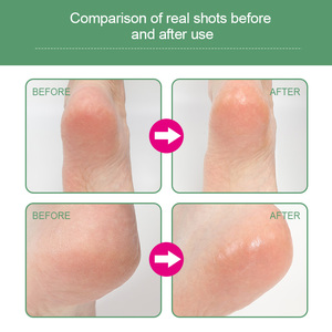 Novedades Trending Productos de belleza Ingredientes Nutritivos <span class=keywords><strong>Pies</strong></span> Hidratantes Cuidado DE LA PIEL <span class=keywords><strong>Crema</strong></span> reparadora - Product Image 5