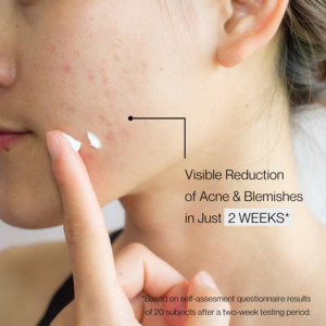 Booster Ultra Chiarificante per la Pelle - Product Image 5