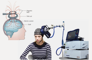 CHMT sistem rehabilitasi aktif, peralatan antarmuka komputer otak untuk pemulihan gangguan kognitif gerakan gangguan Mental - Product Image 5