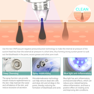 Rechargeable ABS Pore Vacuum Blackhead Remover Caractéristique Comme un nettoyeur de pores pour le traitement de l'acné et le rajeunissement de la peau - Product Image 4