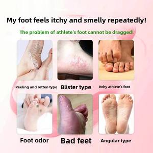 ओस्टोमी त्वचा रक्षक और एंटीफंगल पैर क्रीम-1 खुजली राहत एंटीबैक्टीरियल मेडिकल ग्रेड स्टोमा त्वचा बाधा क्रीम - Product Image 2